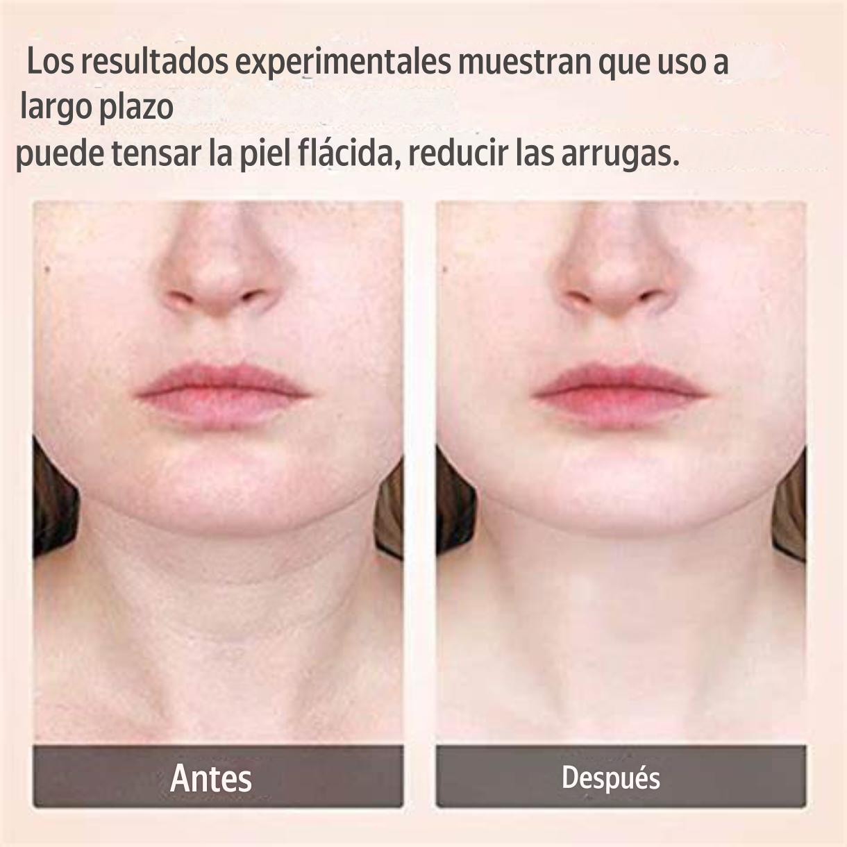 Masajeador Reafirmante Facial con 3 LED